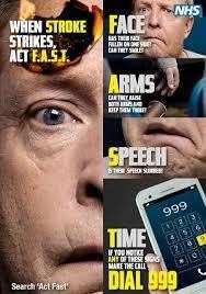 If you suspect a stroke, dial 999 without delay.