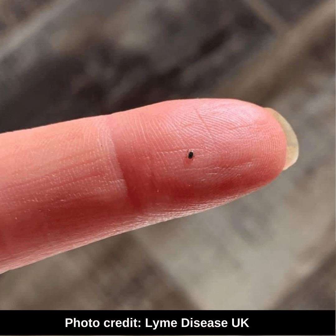 Lyme Disease - tick size
