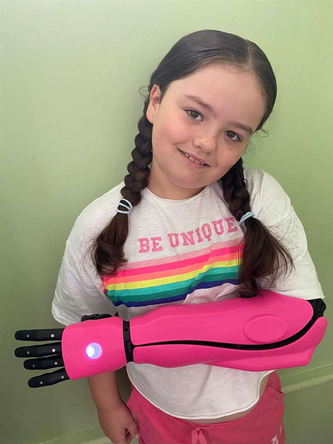 Tallulah’s bionic arm was funded by a donor (Open Bionics/PA)
