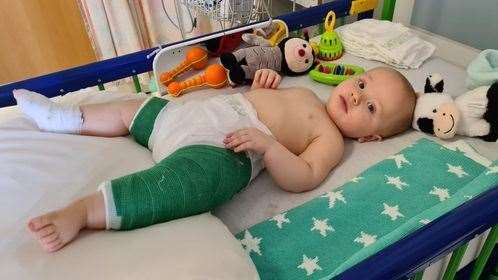 Baby Leo with his cast on.