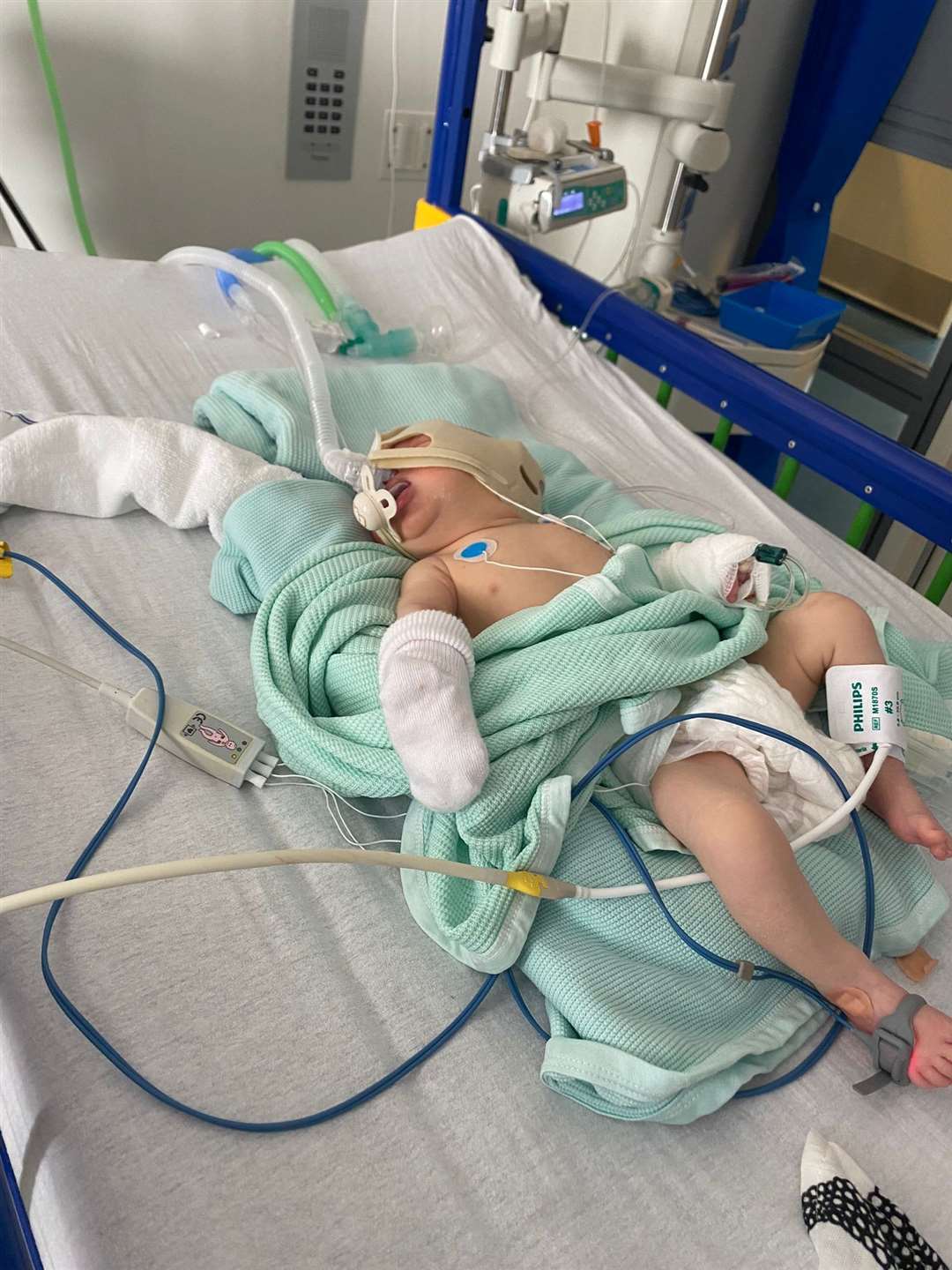 Jackson, who was born four weeks prematurely in 2022 was placed in a ventilator and had to be transported from Aberdeen to Edinburgh with the help of ScotSTAR staff.