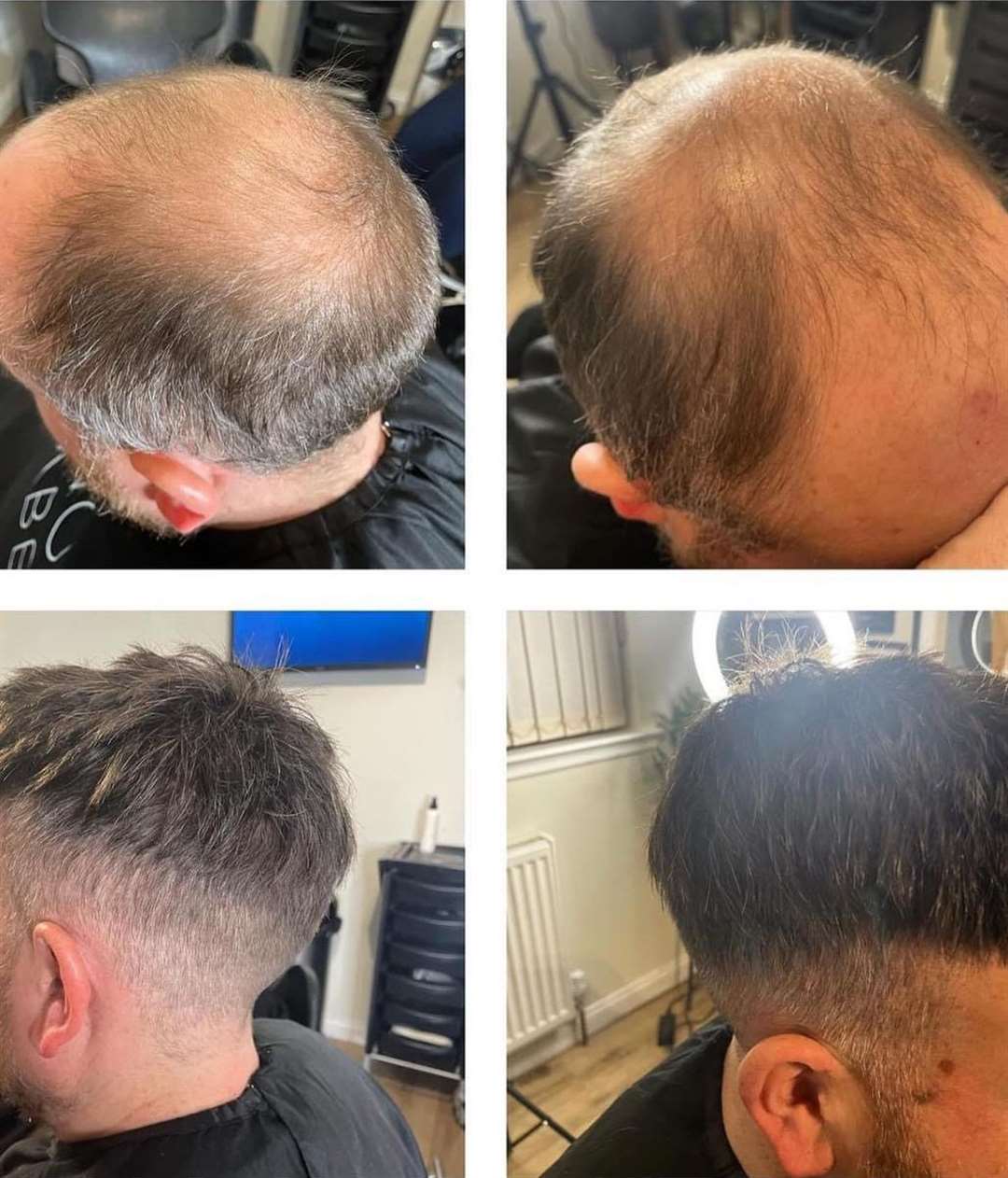 Sarah Murray has worked with many men who have been dealing with hair loss.